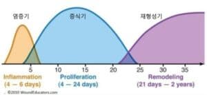 프롤로치료원리